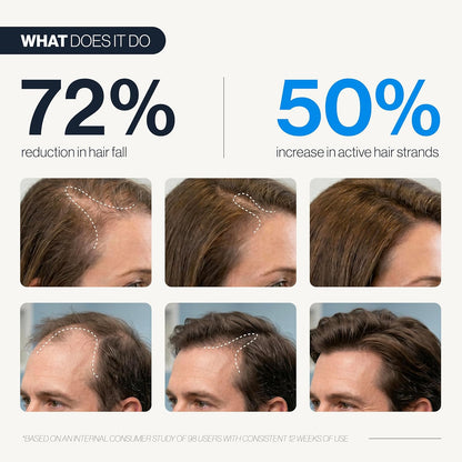 Advanced Hair Growth Roll-On Serum — Target Thicker Roots & Reactivate Follicles Directly