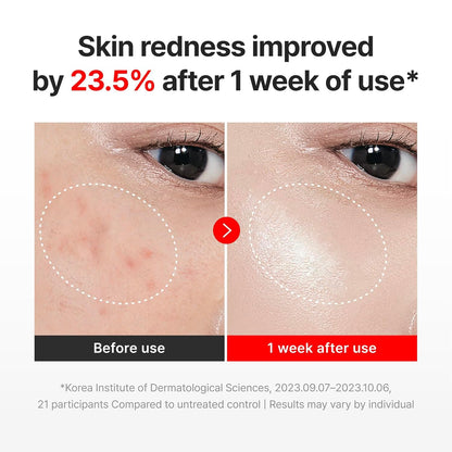 Intensive TECA Cellular Elasticity & Time Reverse Cream