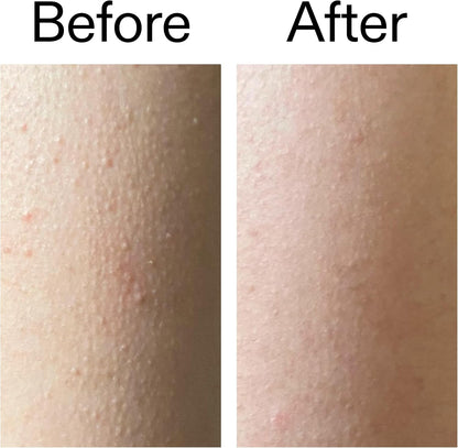 Glycolic Acid Exfoliating Body Stick For Smooth, Bump-Free Skin